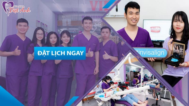 Bọc răng sứ ở Đà Nẵng